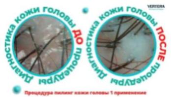 Трихология эстетическая